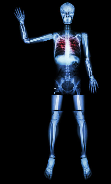 遏制结核病(肺结核)(人骨举手)图片下载