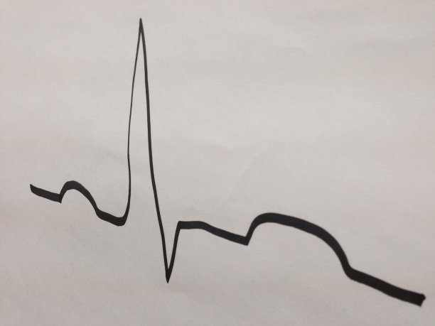 心电图地带图片下载