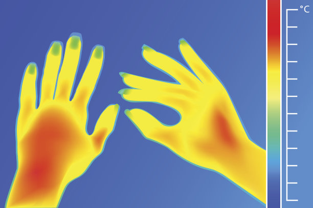 热成像仪人手。用热像仪拍摄的女性手臂图像。温标是华氏度。图片下载