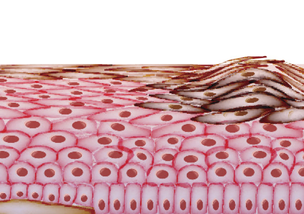 人类皮肤上的黑色素瘤，癌症矢量图图片下载