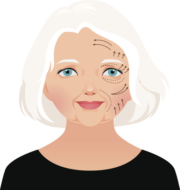 老年女性整容回春的面部拉皮图片下载