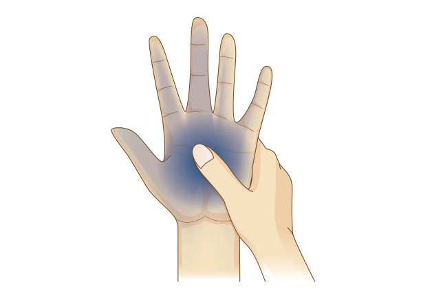 手有麻木症状。图片下载