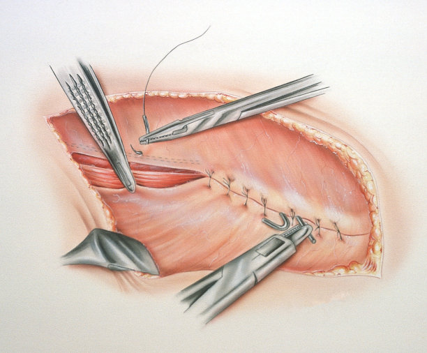 腿手术图片下载