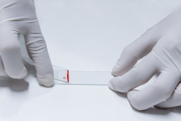 血样涂片法图片下载