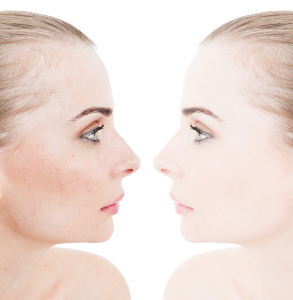 特写美丽的年轻女子的脸前和后修饰图片下载