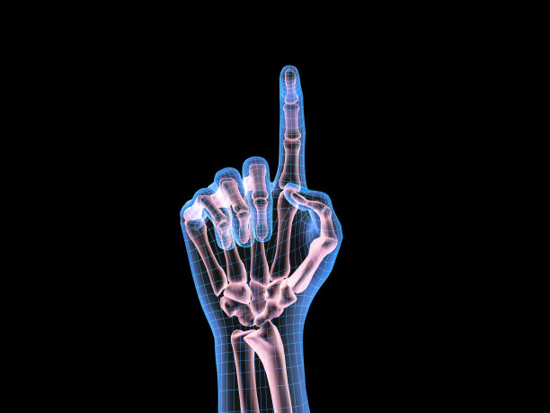 人手的x光图像图片下载