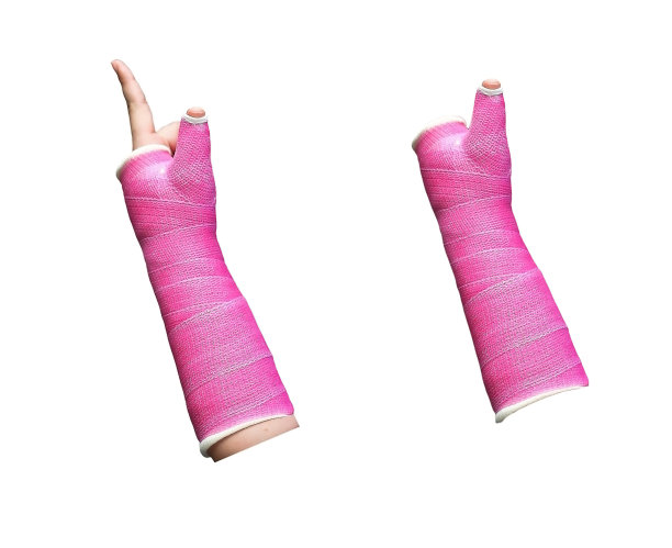 一个女人手臂上的粉色石膏图片下载