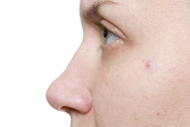 皮肤问题图片下载