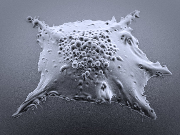肺癌细胞图片下载