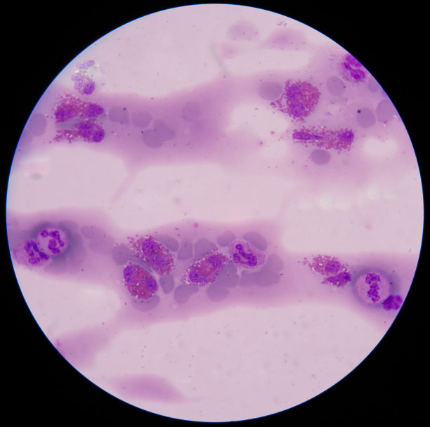 血涂片。图片下载