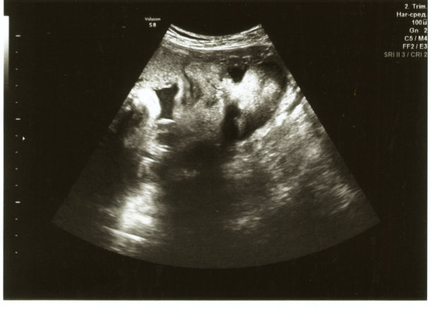 胎儿33周时的面部超声波，超声波图像图片下载