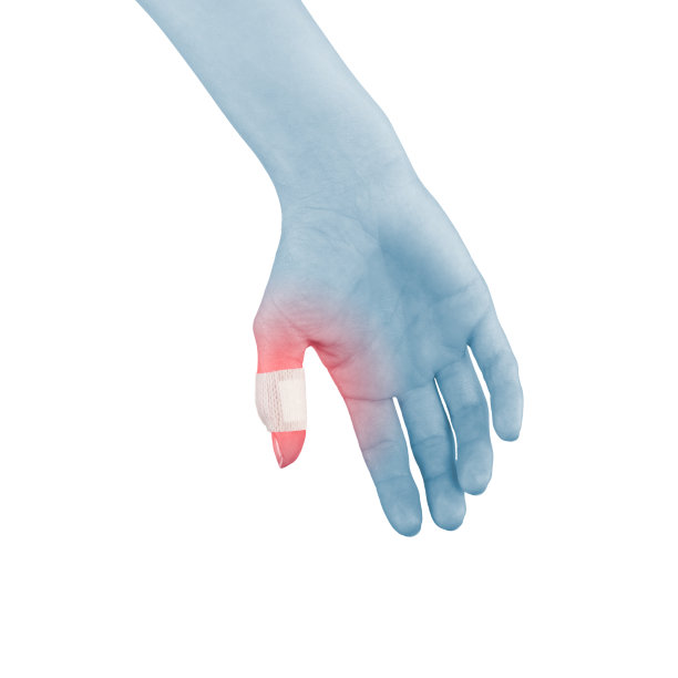 手指上的愈合创可贴。图片下载