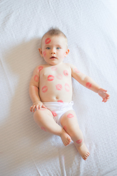 女孩宝宝全身都是红红的吻图片下载