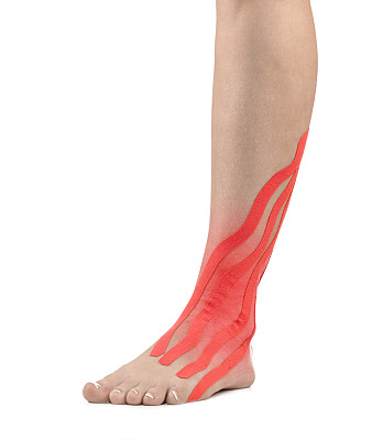 受伤的脚踝图片下载