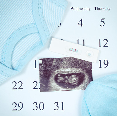 复古照片，孕检，宝宝超声波扫描，日历上新生儿的衣服，期待着宝宝图片下载