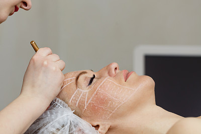 sma材料提高超声波素材图片