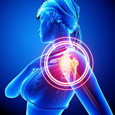 女性肩痛图片下载