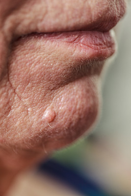 老年退休女性，下巴和嘴唇特写。图片下载