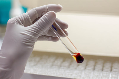 手持血样图片下载