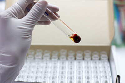 手持血样图片下载