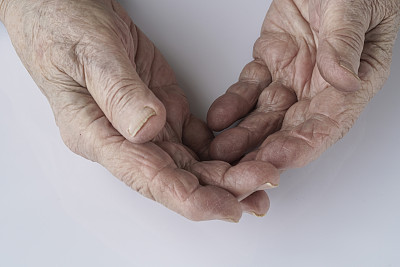 特写一位资深人士布满皱纹的双手图片下载