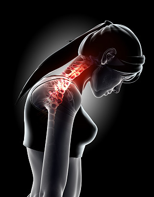 颈部疼痛-颈椎骨骼x光，3D插图。图片下载