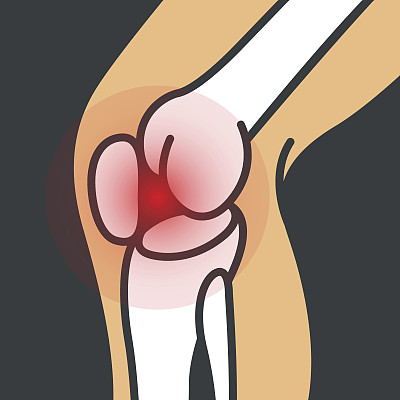 膝盖疼痛矢量图标，
图标插画家图片下载