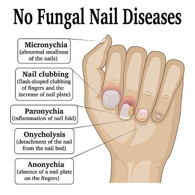 指甲无真菌病图片下载