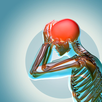 3d医学插图头痛图片下载