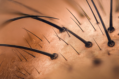 极端放大-飞脸细节在20倍图片下载