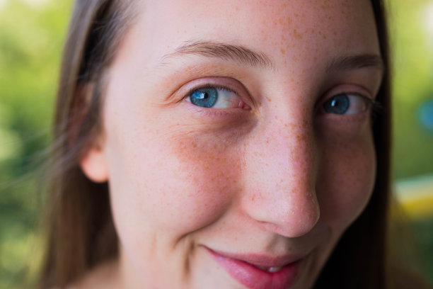 有雀斑的漂亮女人图片下载