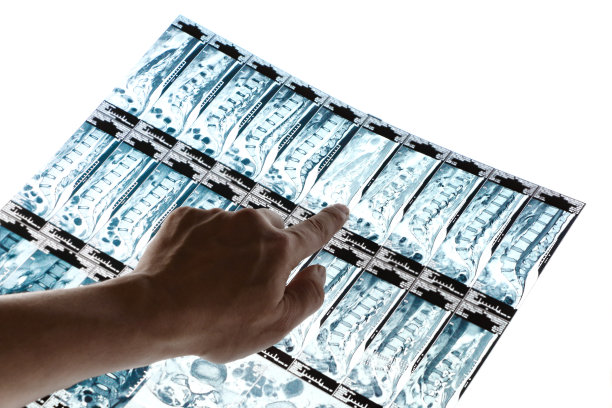 核磁共振图片下载