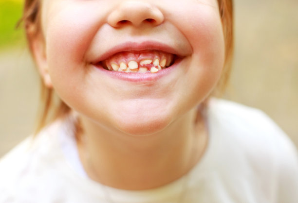 乳牙脱落。婴儿的微笑。图片下载