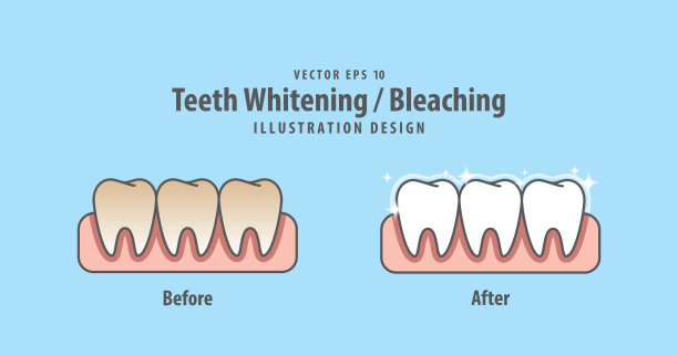 对比牙齿漂白-漂白之前和之后的插图矢量在蓝色背景。牙科的概念。图片下载