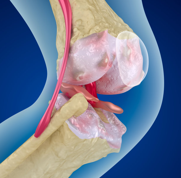 膝关节骨质疏松症，医学上精确的3D插图图片下载