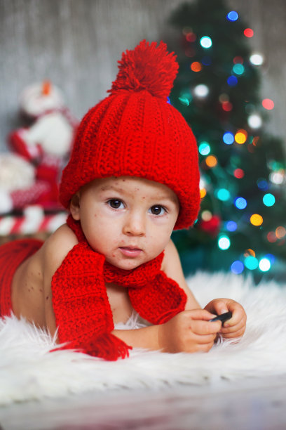 患有水痘，水痘带状疱疹病毒的可爱小男孩戴着圣诞帽图片下载