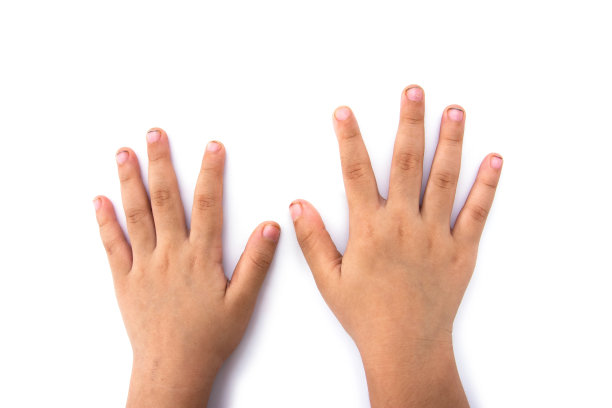 脏孩子的指甲和手孤立在白色的背景上。指甲不干净图片下载