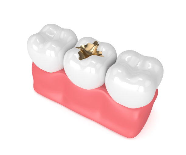 牙齿的3d渲染与牙科金填补图片下载