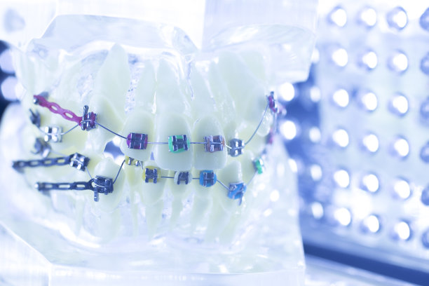 牙齿矫正牙医教学模型牙齿塑料和金属支架对准，以矫正每颗牙齿。图片下载