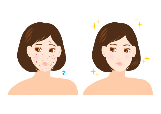 青春痘、色斑、雀斑(女性)图片下载