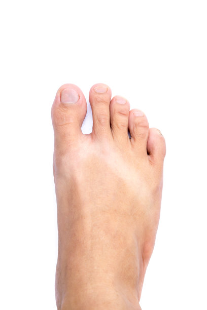 白人背景下的亚洲男人的右脚图片下载