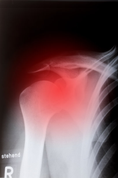 人的肩膀上图片下载