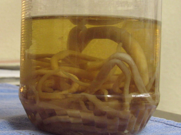 马蛔虫寄生虫图片下载