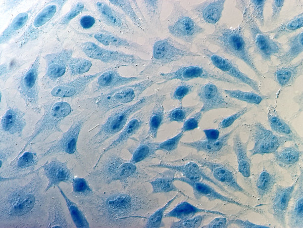 海拉子宫颈癌细胞图片下载