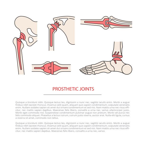 植入关节骨架图片下载