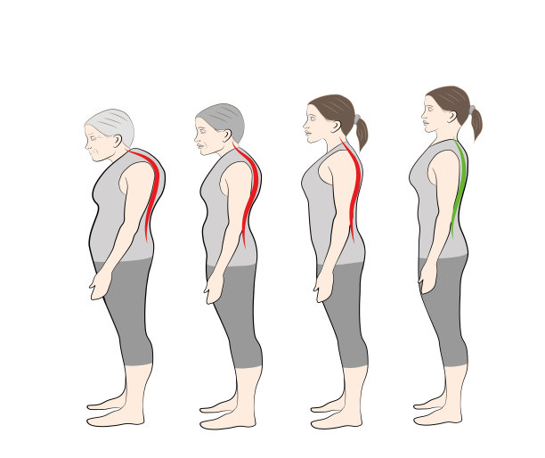 随着年龄的增长出现弯腰的姿势，显示出脊椎的弯曲度增加图片下载