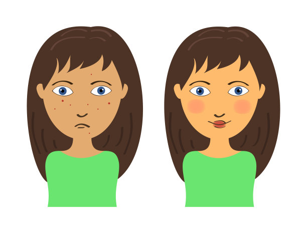 痤疮的女孩图片下载