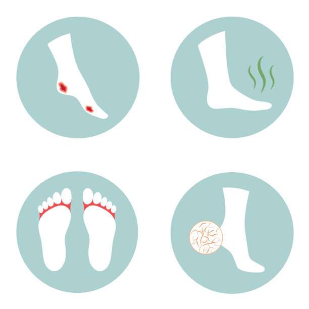 糖尿病溃疡，脚后跟开裂，真菌感染，脚臭图片下载