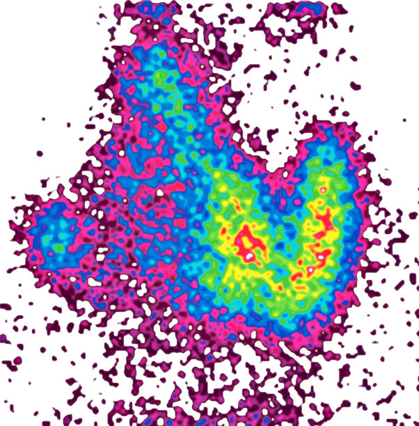 探讨thyriod腺图片下载