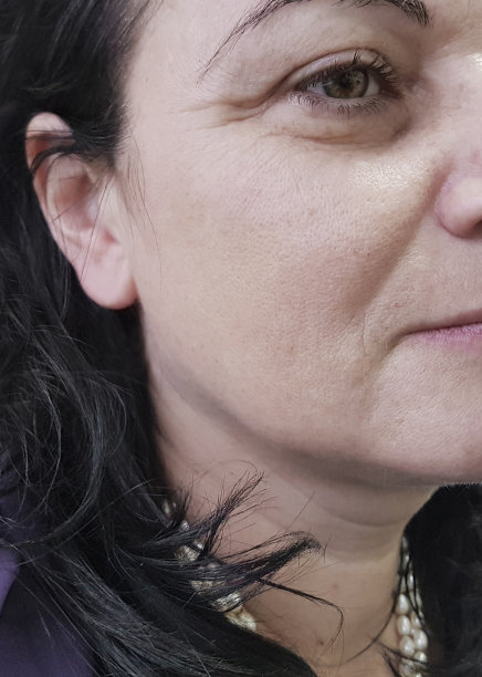 老太太脸上的皱纹图片下载